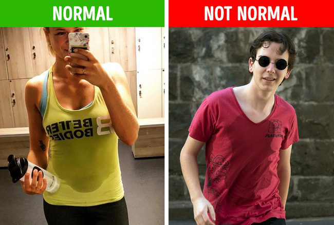 Đừng cố tình bỏ qua 6 biểu hiện ở nách vì nó có thể chỉ ra bệnh tiềm ẩn, không ngoại trừ ung thư-6