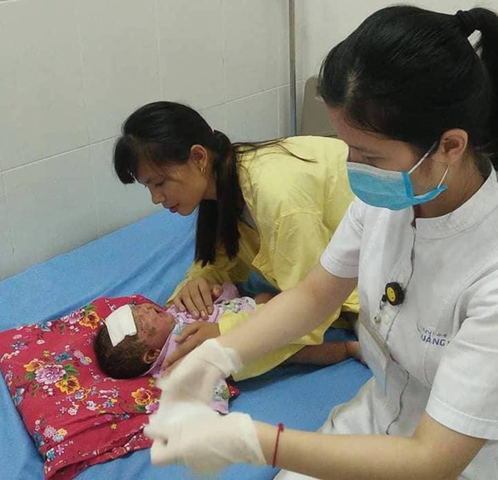 Bé trai 32 ngày tuổi nguy kịch do sai lầm của mẹ dùng nước lá tắm cho con-1