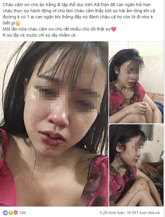 Cô gái xinh đẹp, bức ảnh môi bầm dập và dòng tâm sự cay đắng thu hút 11.000 lượt chia sẻ-1