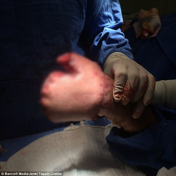 Bác sĩ khâu tay người đàn ông vào dạ dày và cái kết bất ngờ-1