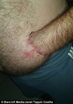 Bác sĩ khâu tay người đàn ông vào dạ dày và cái kết bất ngờ-2