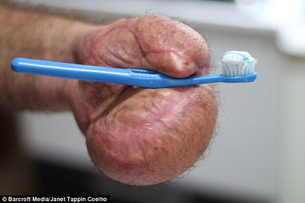 Bác sĩ khâu tay người đàn ông vào dạ dày và cái kết bất ngờ-4