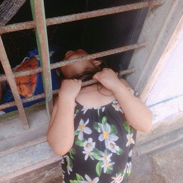 Bé gái nghịch dại kẹt đầu vào song sắt cửa sổ, phụ huynh phải dùng cưa máy để giải cứu-1