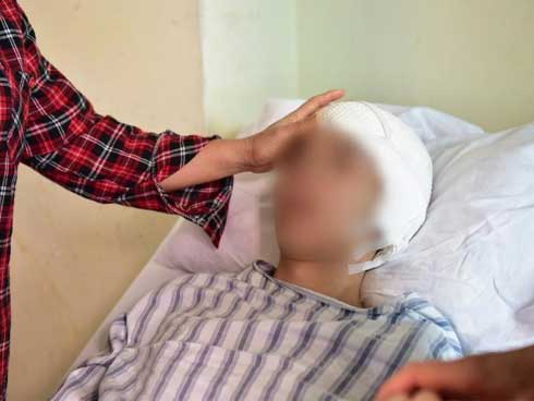 Chàng trai trẻ 29 tuổi bị xuất huyết não, thói quen tai hại của anh nhiều người có-2