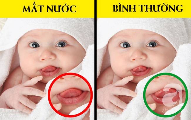 Giúp cha mẹ nhận biết và điều trị virus rota - căn bệnh khiến trẻ suy kiệt nhanh chóng-5