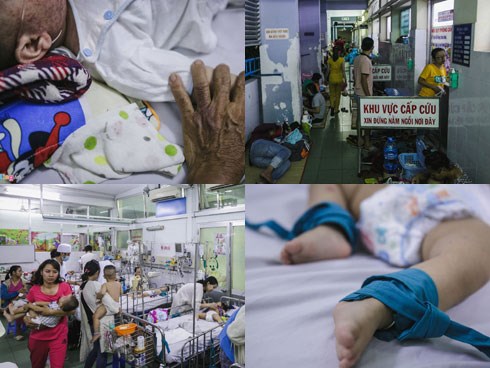 Bệnh viện Nhi ở Sài Gòn vỡ trận vì dịch chồng dịch