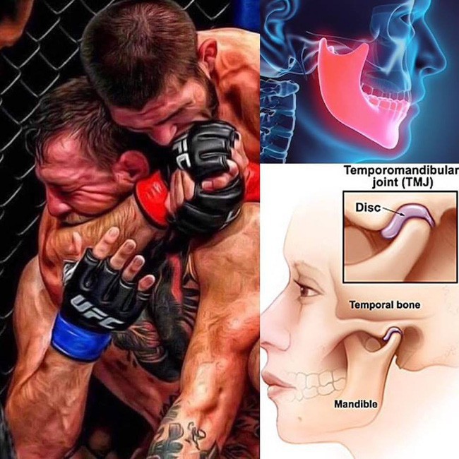 Đòn khóa cực hiểm khiến Gã điên phải đầu hàng: Chậm một giây là gãy cổ, vỡ hàm-3