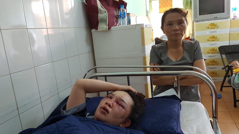 Nữ nhân viên spa tố bị bắt cóc, đánh đập dã man-1