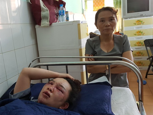 Xe khách va chạm ôtô bán tải, 7 người thương vong-3