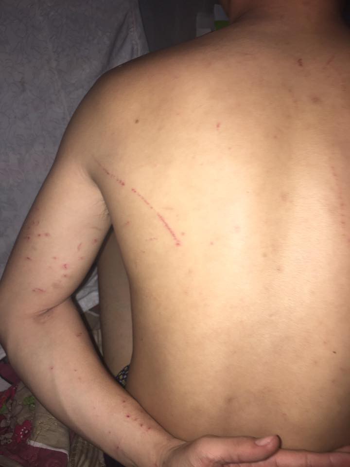 Vợ trẻ tố chồng đánh mình giữa đêm và cách cô phản ứng dữ dội, hội chị em ngồi hóng chỉ chú ý đến chi tiết này-4