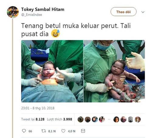 Em bé gây bão vì chào đời không thèm khóc, chưng ngay vẻ mặt: Sao lại lôi cháu ra đây!-1