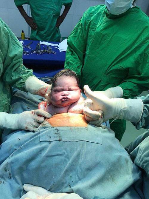 Em bé gây bão vì chào đời không thèm khóc, chưng ngay vẻ mặt: Sao lại lôi cháu ra đây!-2