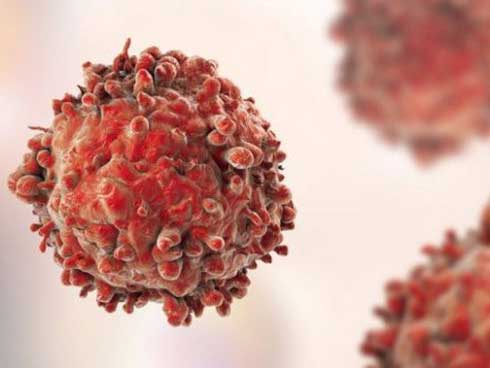 7 dấu hiệu sớm của ung thư máu-1