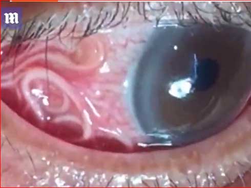 Cho con sang hàng xóm chơi, cha mẹ chẳng ngờ vài ngày sau phải đưa con nhập viện-3