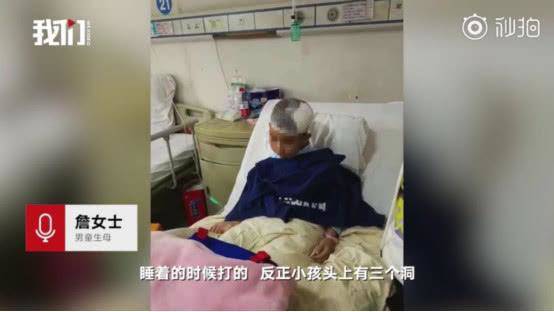 Bé 5 tuổi bị bạn gái của bố đập búa liên tiếp vào đầu nhưng không dám khóc, mách bố-2