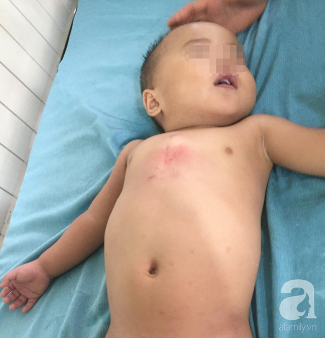 Mẹ bận bán rau trước nhà, con trai 19 tháng tuổi chúi đầu vào thùng nước ngưng tim-1