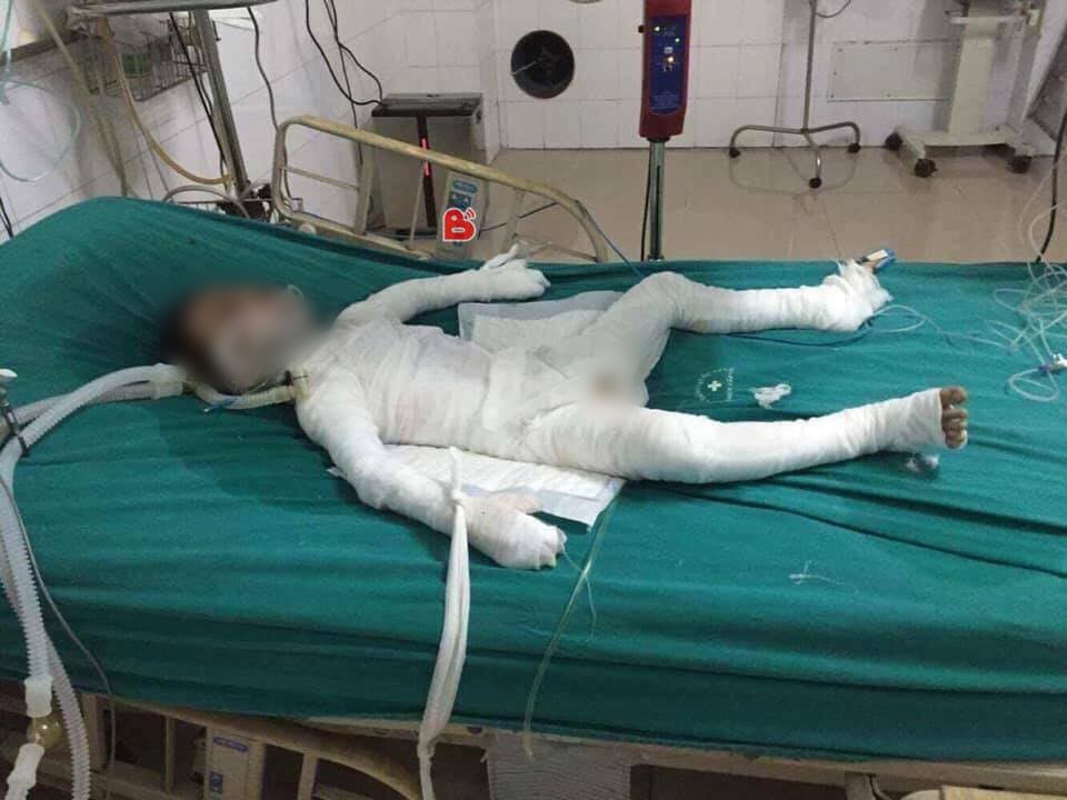 Vụ bé trai 6 tuổi bị bố dượng tẩm xăng đốt: Trước lúc mất, cháu chỉ hỏi bố Linh có sao không mẹ...-3