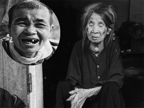 Bà mẹ mù gần 90 tuổi và con gái tâm thần giữa Hà Nội: Được nghe nhiều tiếng người đến chơi là mừng lắm-14