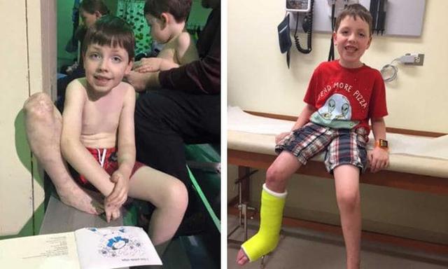 Chưa kịp mừng con ra đời, mẹ suýt ngất khi thấy chân con bầm tím như bị đánh đập-4