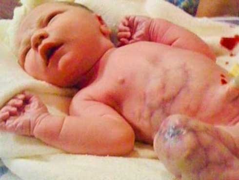 Chưa kịp mừng con ra đời, mẹ suýt ngất khi thấy chân con bầm tím như bị đánh đập