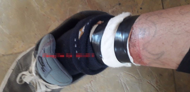 Vợ báo người yêu cũ có chuyện, dặn trông con, chồng vội về và cái kết vừa đau vừa tức-2