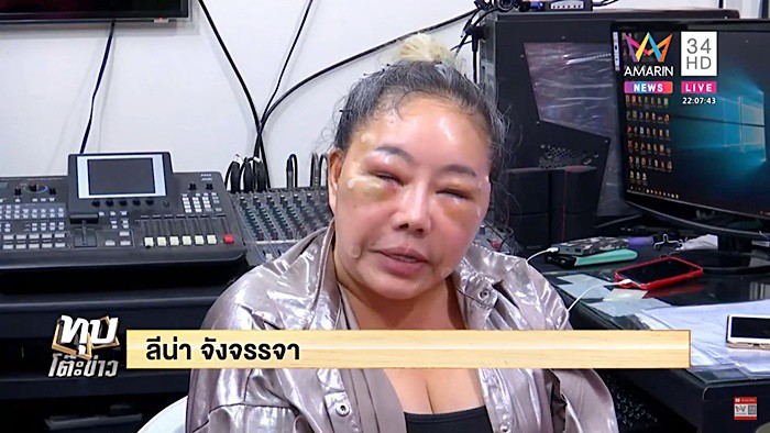 Nữ đại gia Thái Lan đổi chồng như thay áo năm nào gây sốc với gương mặt sưng vù vì bị chồng mới đánh đập?-3
