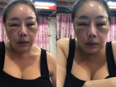 Nữ đại gia đổi chồng như thay áo lại gây sốc với gương mặt V-line xinh đẹp và thân hình thon gọn đến khó tin-10