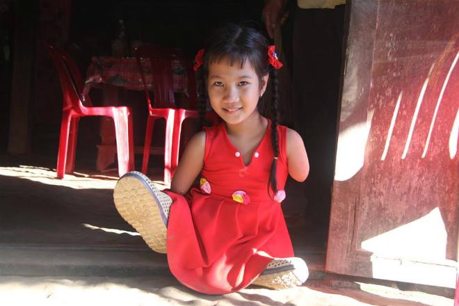 Cô bé chim cánh cụt” và câu hỏi ngây ngô: Sao mẹ đẻ con ra cụt cả chân lẫn tay”-1