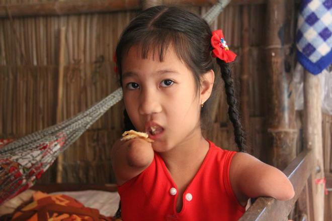 Cô bé chim cánh cụt” và câu hỏi ngây ngô: Sao mẹ đẻ con ra cụt cả chân lẫn tay”-3