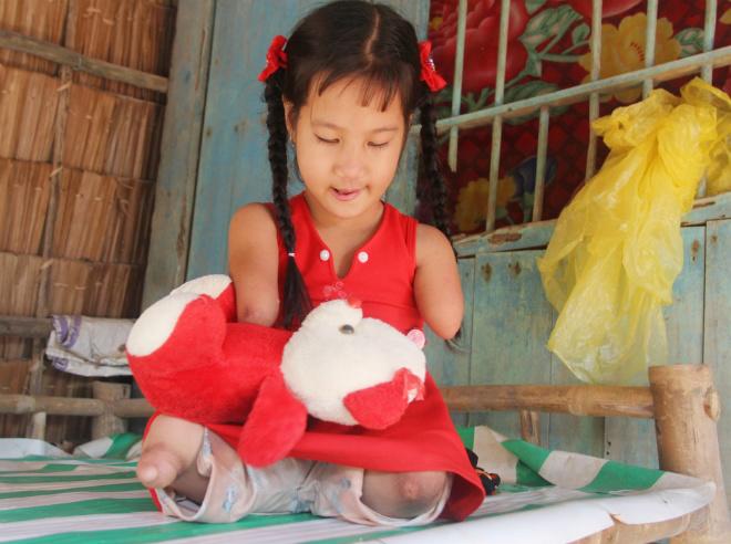 Cô bé chim cánh cụt” và câu hỏi ngây ngô: Sao mẹ đẻ con ra cụt cả chân lẫn tay”-4