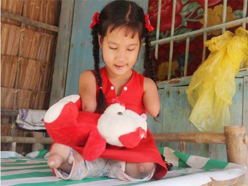 Chàng sinh viên Hà Nội mất 2 cánh tay trước ngày thi Đại học: Còn sống thì sống cho đáng, mọi chuyện rồi sẽ tốt lên-32