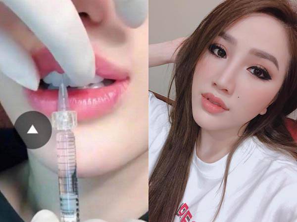 Xém chút không nhận ra Bảo Thy vì gương mặt quá khác lạ như phẫu thuật hỏng-11