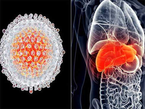 Vì sao người Việt dễ mắc ung thư gan: Chuyên gia cảnh báo 3 lý do-1
