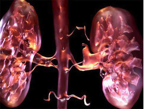 Bác sĩ BV Bạch Mai cảnh báo thói quen hại thận rất nhiều người mắc mà không biết-2