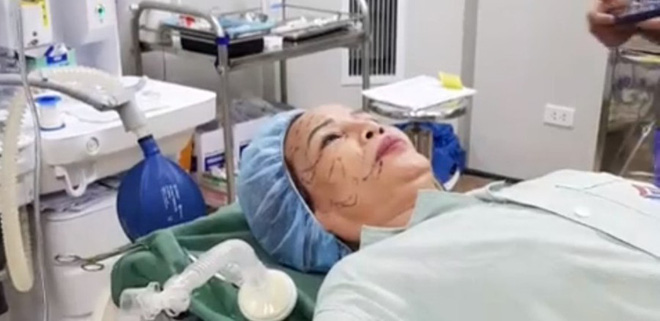 Cô dâu 62 tuổi tiến hành phẫu thuật thẩm mỹ, nhan sắc mới trẻ trung như ở tuổi 40-3