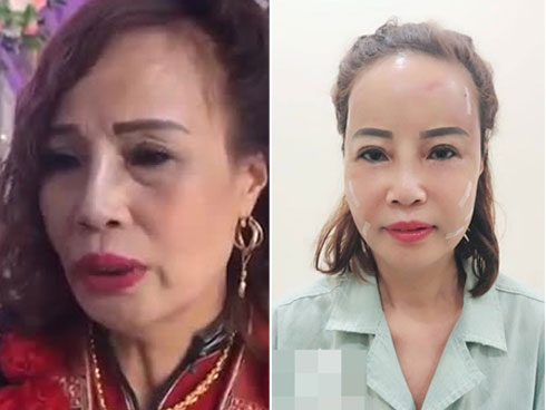 Cô dâu 62 tuổi đăng ảnh mới nhất sau phẫu thuật, chồng chia sẻ vẫn chưa thể nói chuyện-8