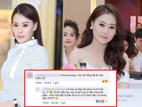 Chuyện hài hước: Bạn diễn không nhận ra Phương Oanh Quỳnh búp bê sau phẫu thuật thẩm mỹ-4