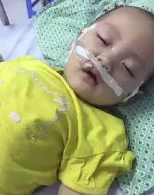 Bị biến chứng sau khi mắc tay chân miệng, bé 14 tháng bỗng dừng tập đi-1