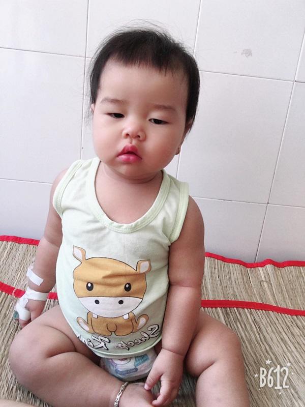 Bị biến chứng sau khi mắc tay chân miệng, bé 14 tháng bỗng dừng tập đi-3