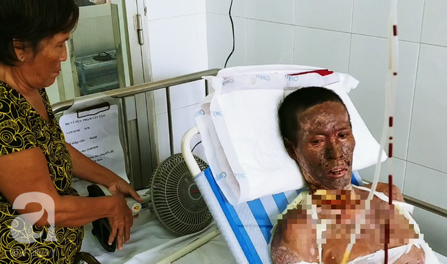 Người phụ nữ mất em trai, nuôi chồng nguy kịch vì cháy nhà: Nếu có phép màu, em chỉ mong được đổi mạng cho chồng”-6