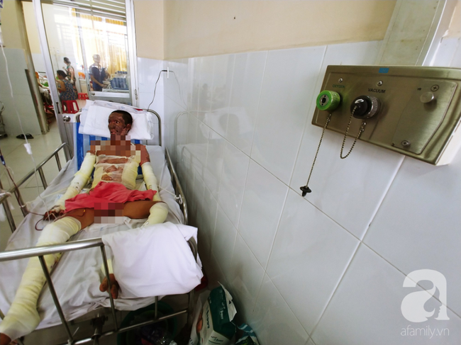 Người phụ nữ mất em trai, nuôi chồng nguy kịch vì cháy nhà: Nếu có phép màu, em chỉ mong được đổi mạng cho chồng”-9