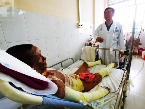 Người phụ nữ mất em trai, nuôi chồng nguy kịch vì cháy nhà: “Nếu có phép màu, em chỉ mong được đổi mạng cho chồng”