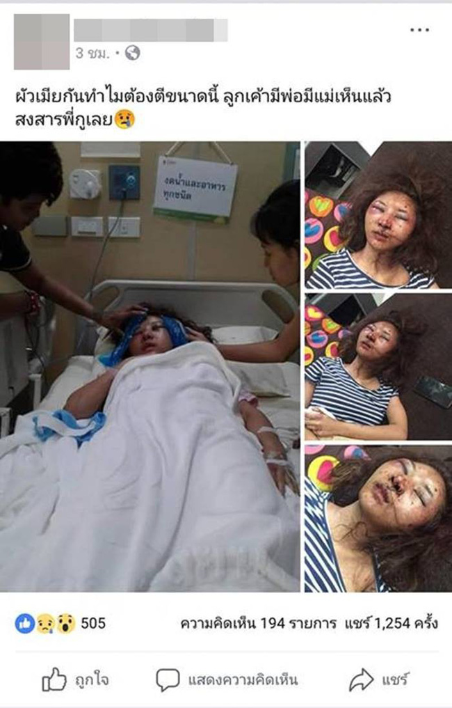 Sốc với gương mặt biến dạng trầm trọng của mẹ trẻ xinh đẹp bị chồng đánh vì trót để người yêu cũ đưa về nhà-1