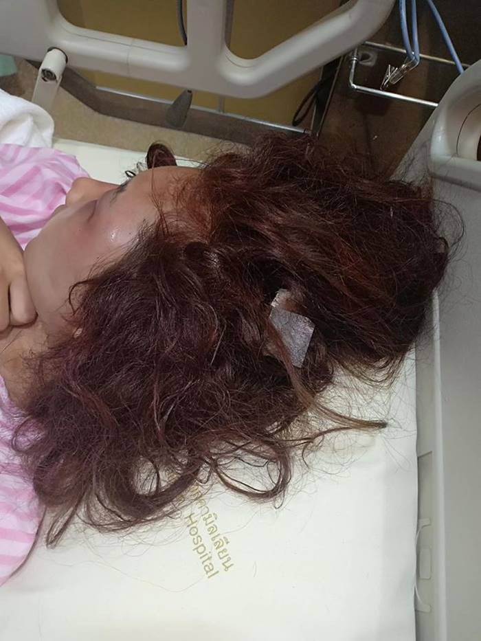 Sốc với gương mặt biến dạng trầm trọng của mẹ trẻ xinh đẹp bị chồng đánh vì trót để người yêu cũ đưa về nhà-2