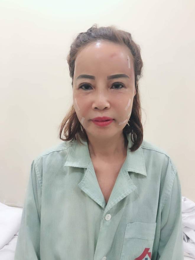 Tiết lộ sốc của cô dâu 62 lấy chồng 26 tuổi về diện mạo mới như thiếu nữ 18-4