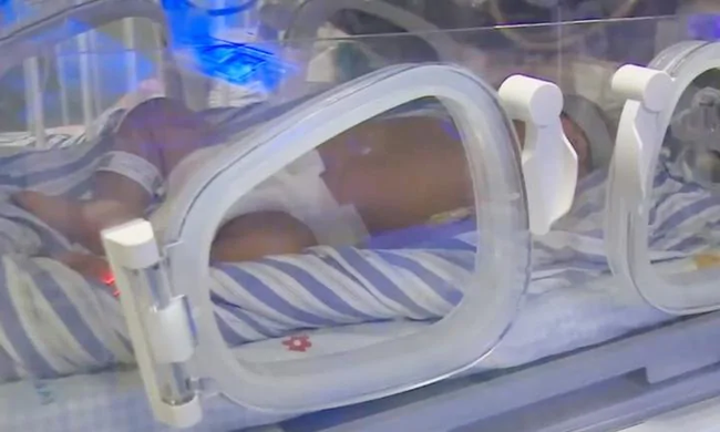 Làm theo mẹo dân gian, cha mẹ dùng kim châm liên tiếp quanh rốn bé mới sinh để dỗ con nín khóc-4