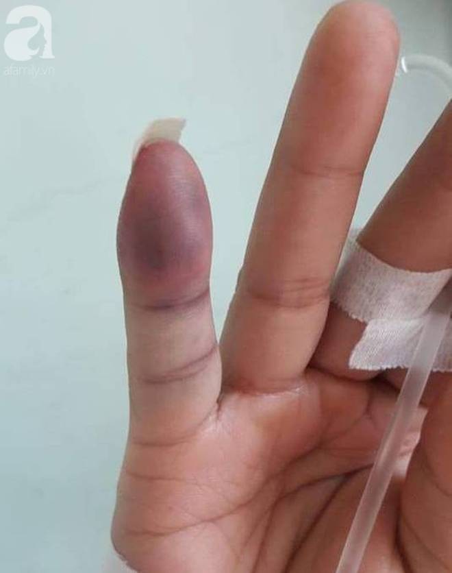 Người đàn ông kiệt quệ sau khi bị bạn gái thuê 5 côn đồ truy sát-3