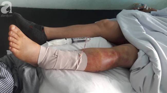 Người đàn ông kiệt quệ sau khi bị bạn gái thuê 5 côn đồ truy sát-4