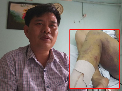 Bị ngăn chặt cây hoa sữa, 8 người xông ra đánh, chém vợ chồng hàng xóm dã man-5