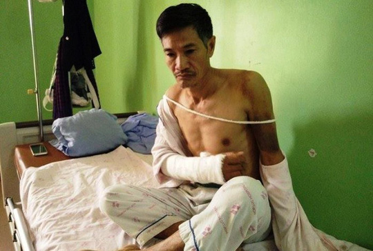 Bị ngăn chặt cây hoa sữa, 8 người xông ra đánh, chém vợ chồng hàng xóm dã man-3